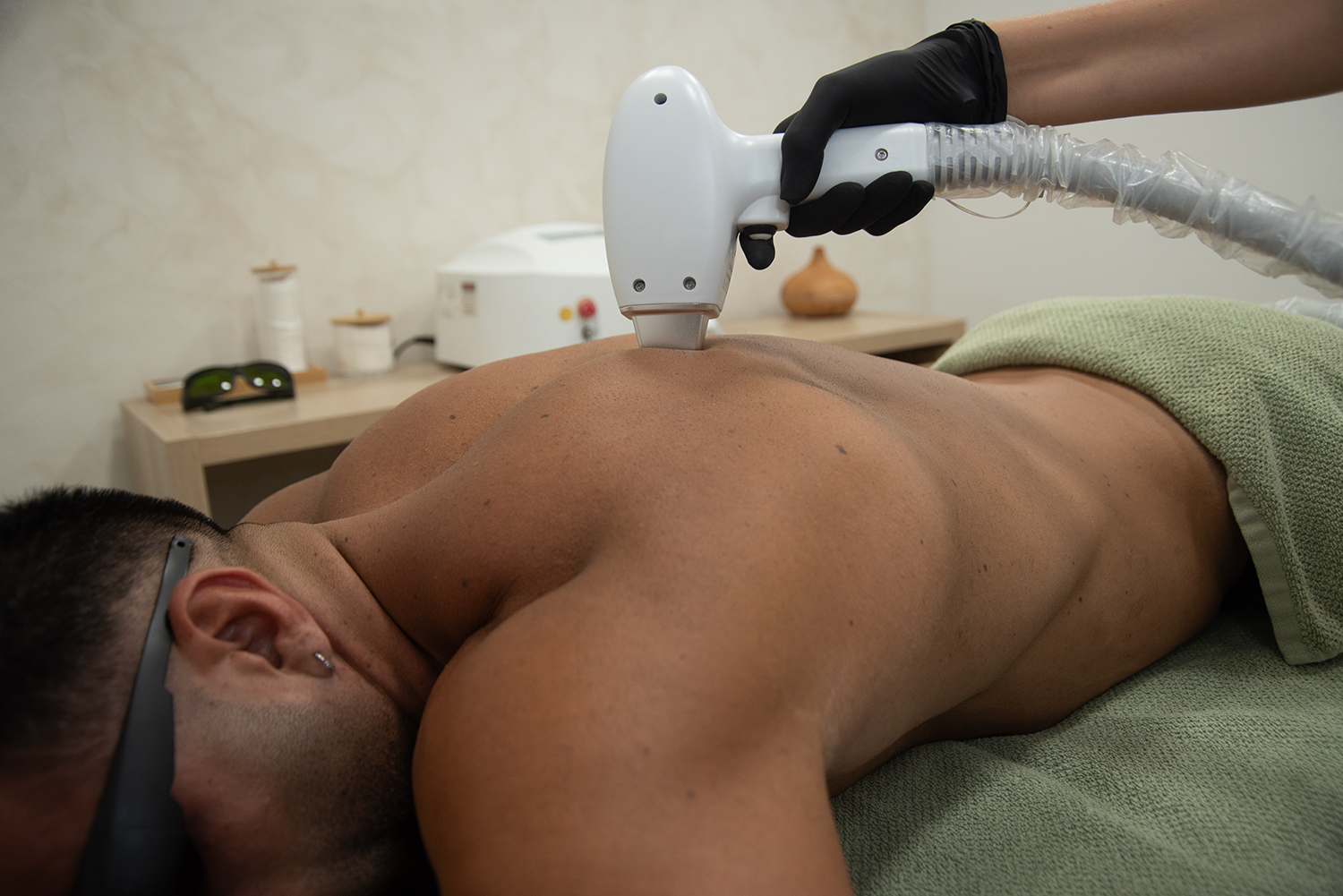 Depilación láser Trionda